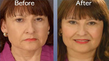 Load image into Gallery viewer, Art Harding's Instant Face and Neck Lift