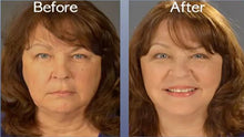 Load image into Gallery viewer, Art Harding's Instant Face and Neck Lift

